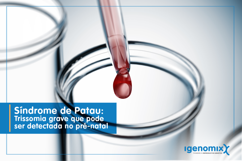 Síndrome de Patau pode ser detectada a partir da décima semana de gestação