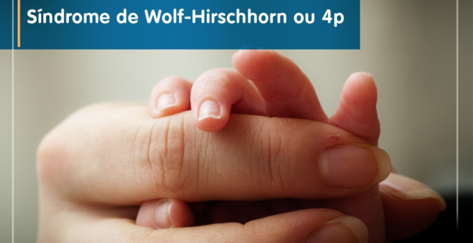 Síndrome de Wolf-Hirschhorn ou 4p, o que é?